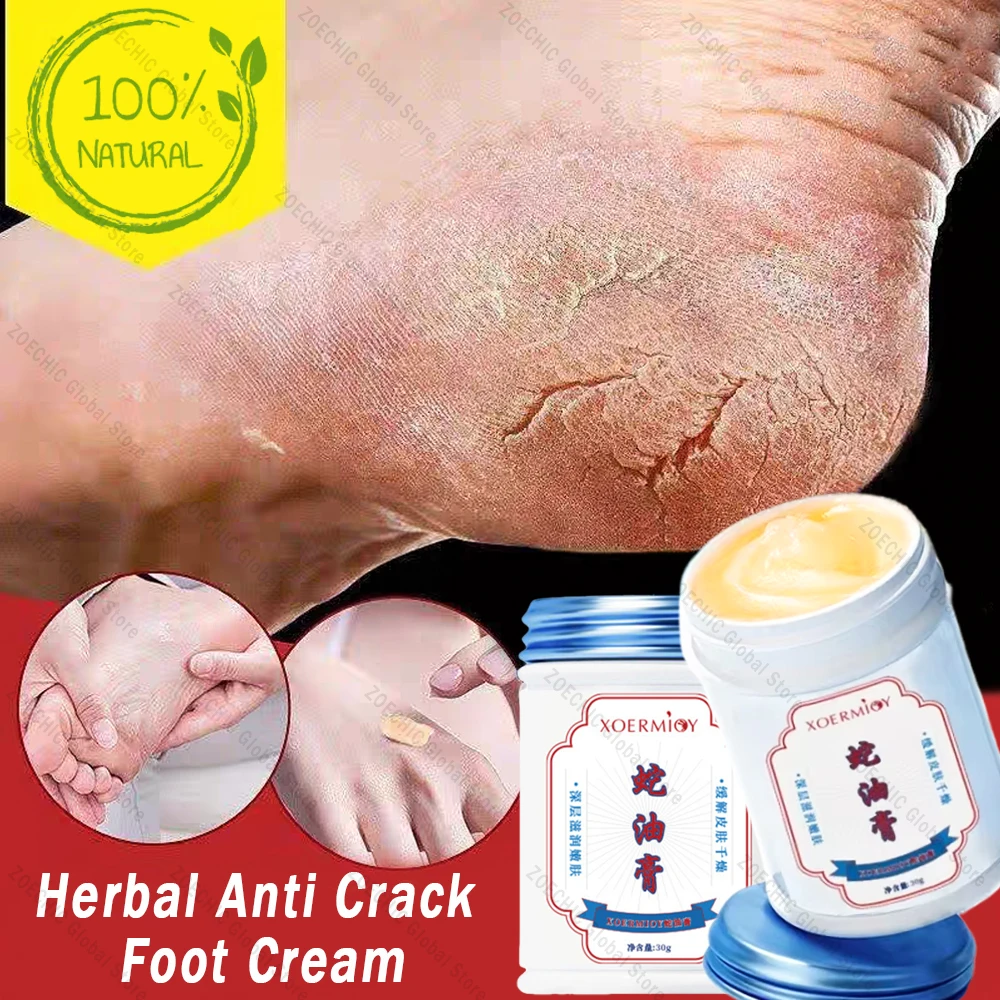 Herbal Anti Crack Foot Cream Heel Cracking Repair Products Exfoliation Dead Skin Removal Softening Moisturize Smooth Skin Care