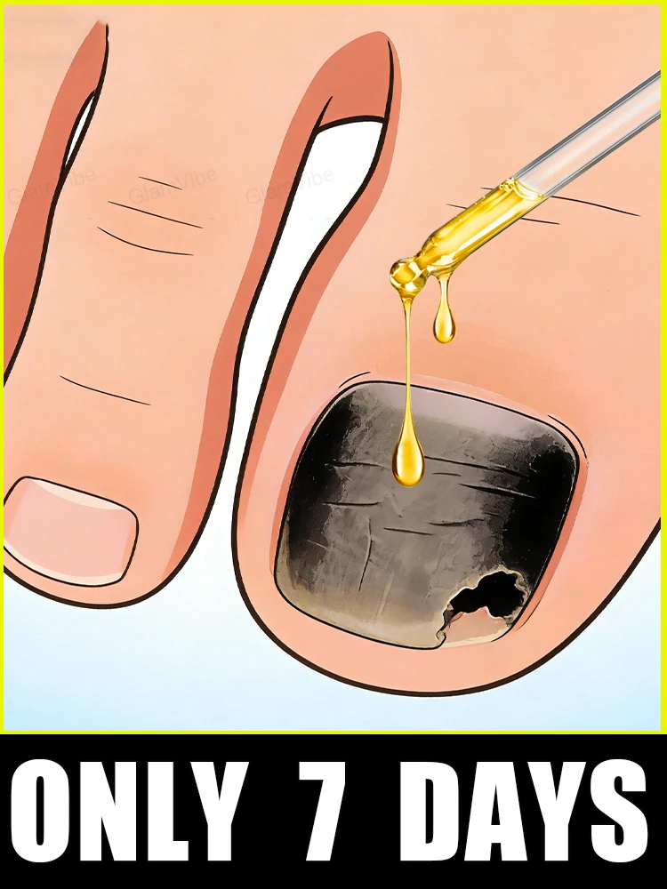 

Fast penetration, nails become translucent and fungal free.