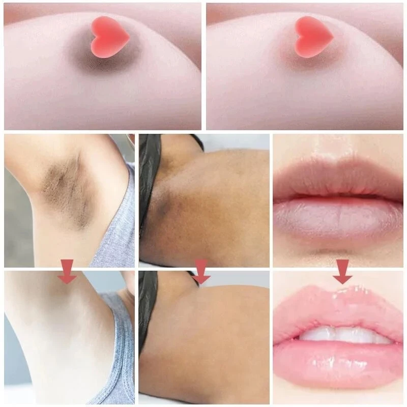 2/5pcs Bioaqua White ning Creme Lippen White ning privaten Teil Achsel Körper Gel Lippen Brustwarzen Schamlippen feminin rosa Mädchen Körper creme