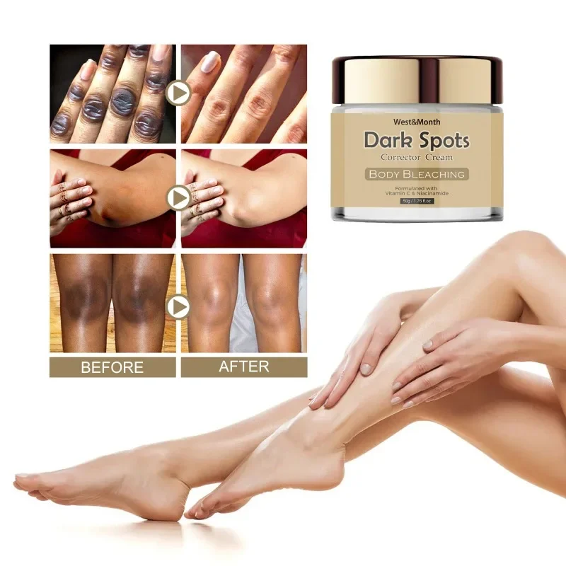 Dark spot correction cream repair elbow armpit joints whitening Knee Inner Thigh Bleach remove Melanin moisturizing Skin care