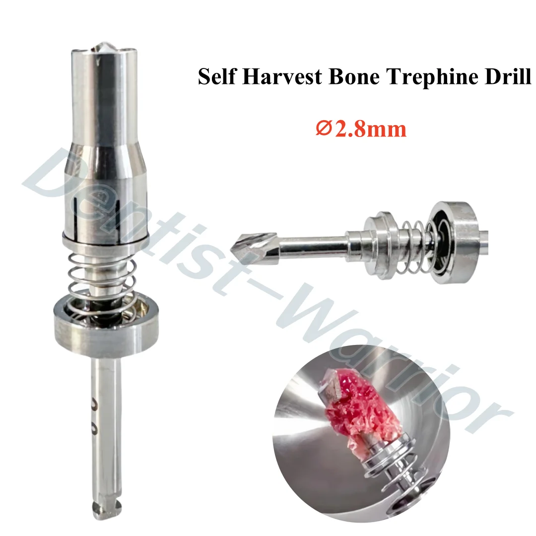 Dental Spring Bone Harvest Drill Implant GBR Collection Trephine Drills ⌀2.8mm