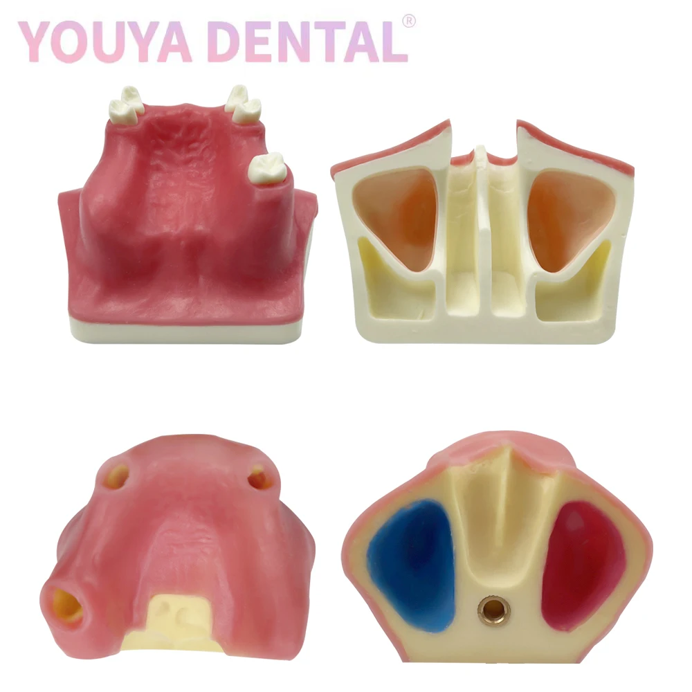 Dental Implant Practice Model Maxillary Mandibular Basic Implant Training Model With Soft Gums Suitable For Students To Practice