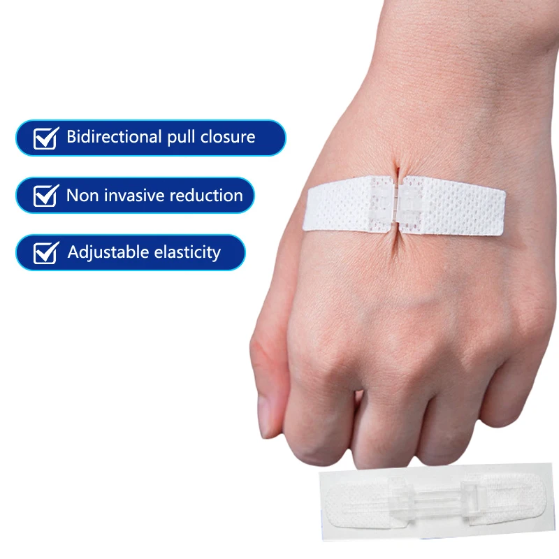 Rits Pleister Pijnloos Wondsluiting Patch Hechtvrije Wondverband Patches Zip Hechtdraad Reducer Pleister Buiten Draagbaar