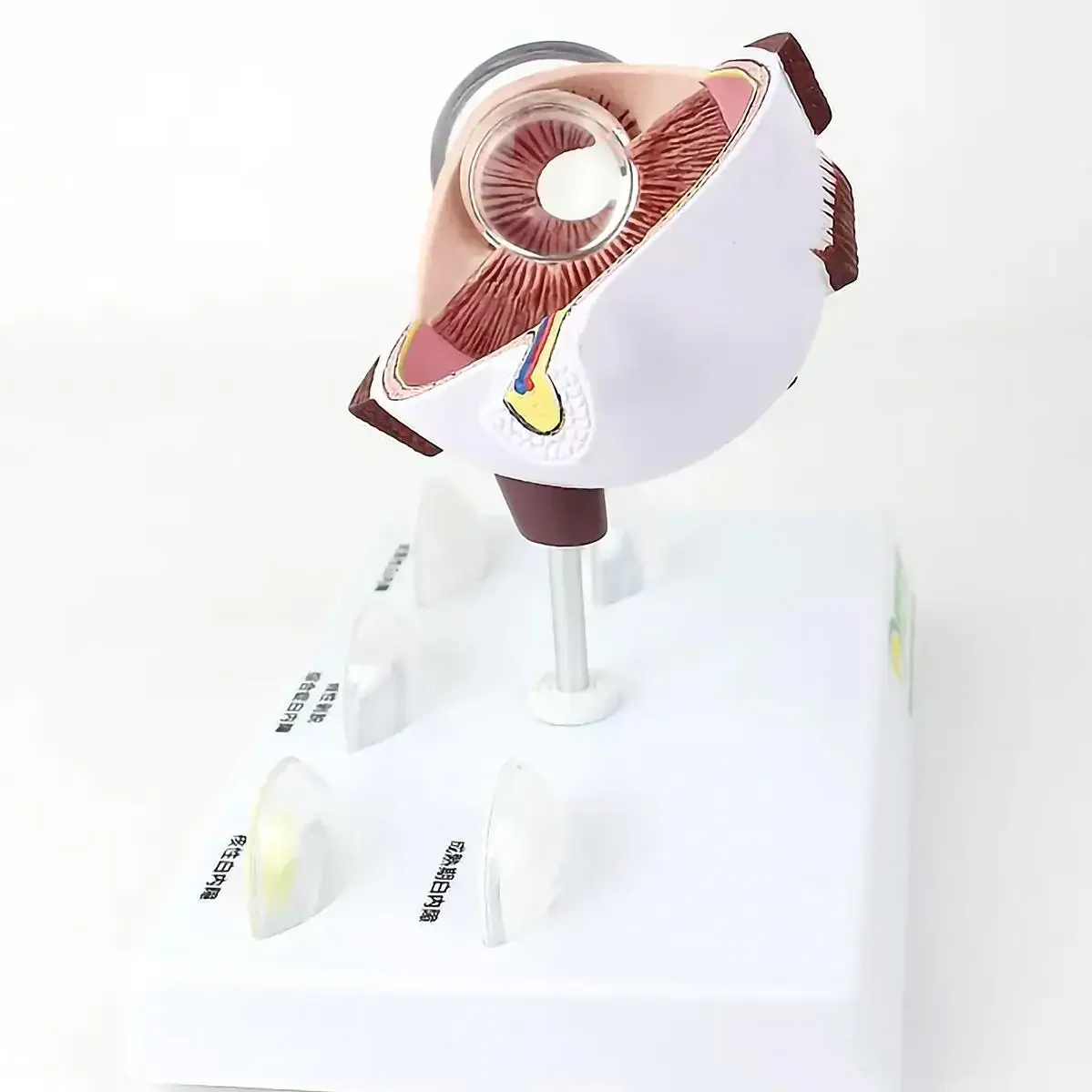 Human Cataract Magnification Eye Internal Anatomy Model Medical Teaching Models