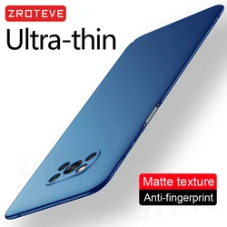 For PocoX3 NFC Case ZROTEVE Slim Hard PC Frosted Cover For Xiaomi Poco X3 X4 X5 X6 Pro Xiomi Mi Pocophone F3 F4 GT F5 5G Cases