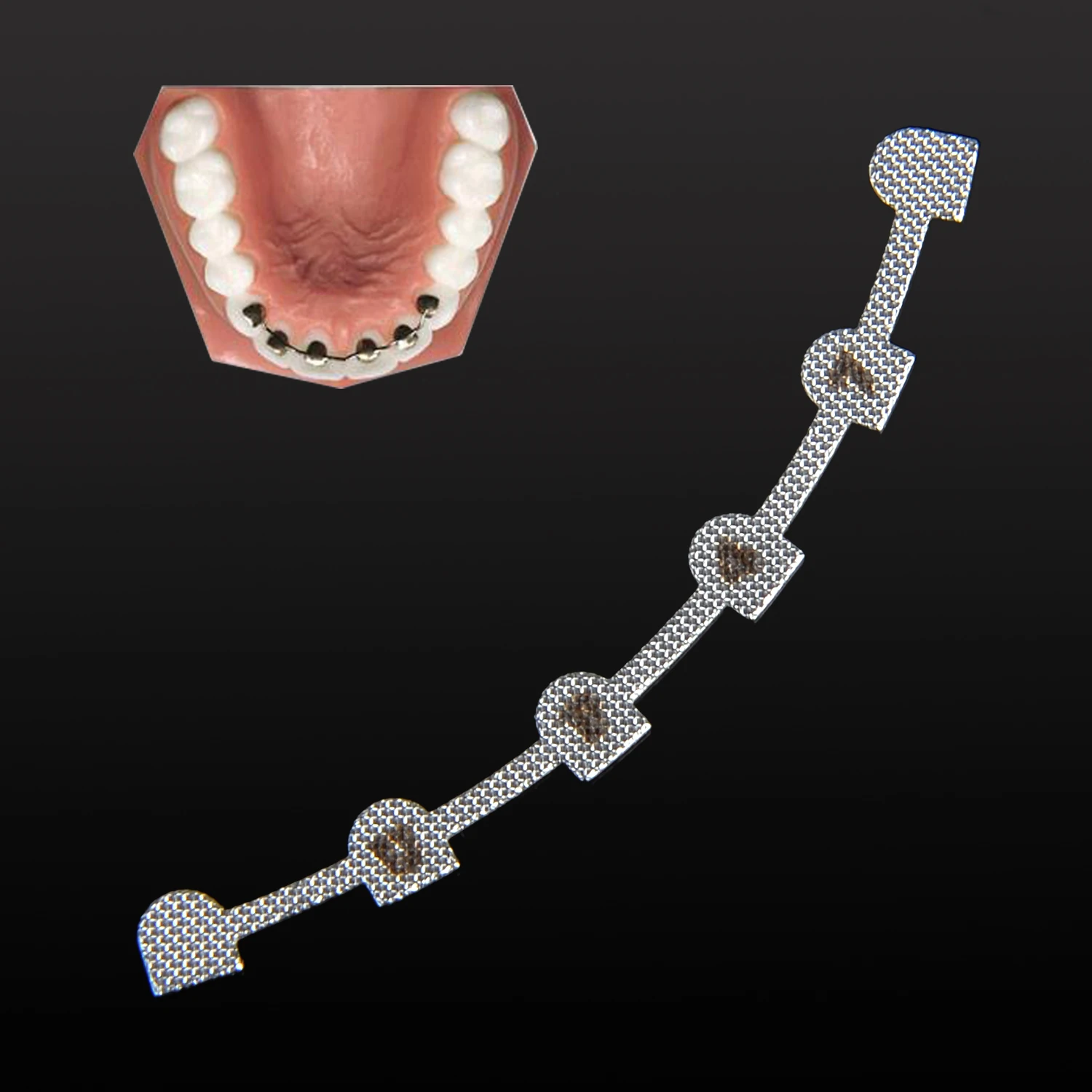 10 Stück/Packung AZDENT Dental Kieferorthopädischer Lingualer Retainer mit Markierung U38 # -47 # Oberes L29 # -37 # Niedriger – Detail 6