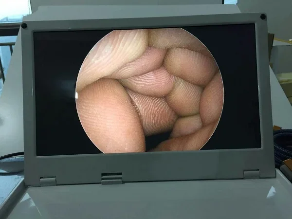 Professionele draagbare veterinaire endoscoop met