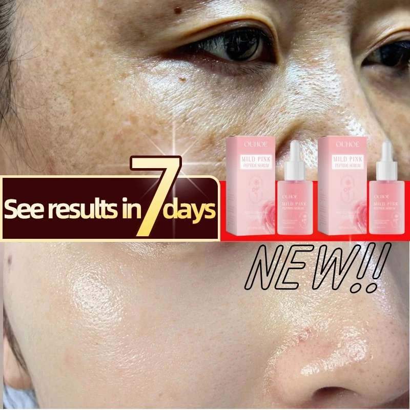 

Mild Pink Peptide Serum Face Whitening Freckles Remove Dark Spots Melanin Anti-Aging Rose Oil Hyaluronic Acid Brighten Skin Care