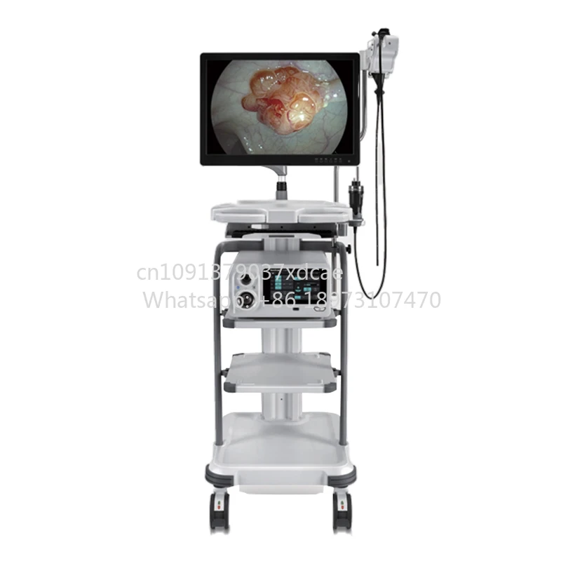 2026 New Sonoscape X-2600 Electronic Endoscope Endoscope Camera . Endoscope Camera