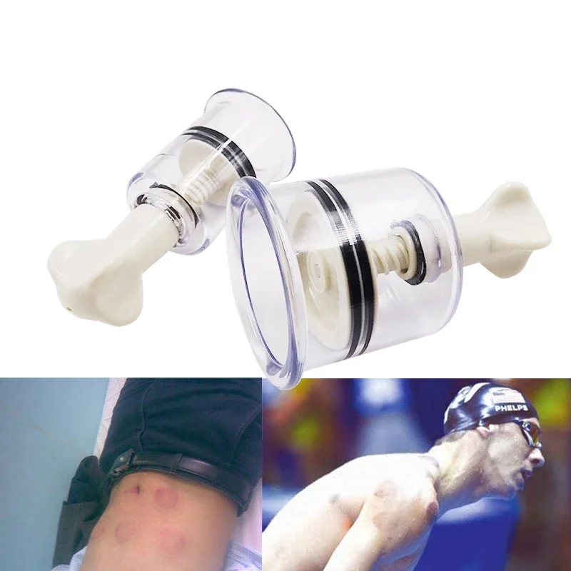 Chinese Medical Vacuum Cupping Cups Plastic Screw Type Vacuum Suction Cups Anti-cellulite Massager Relaxing Massage Hijama Jars