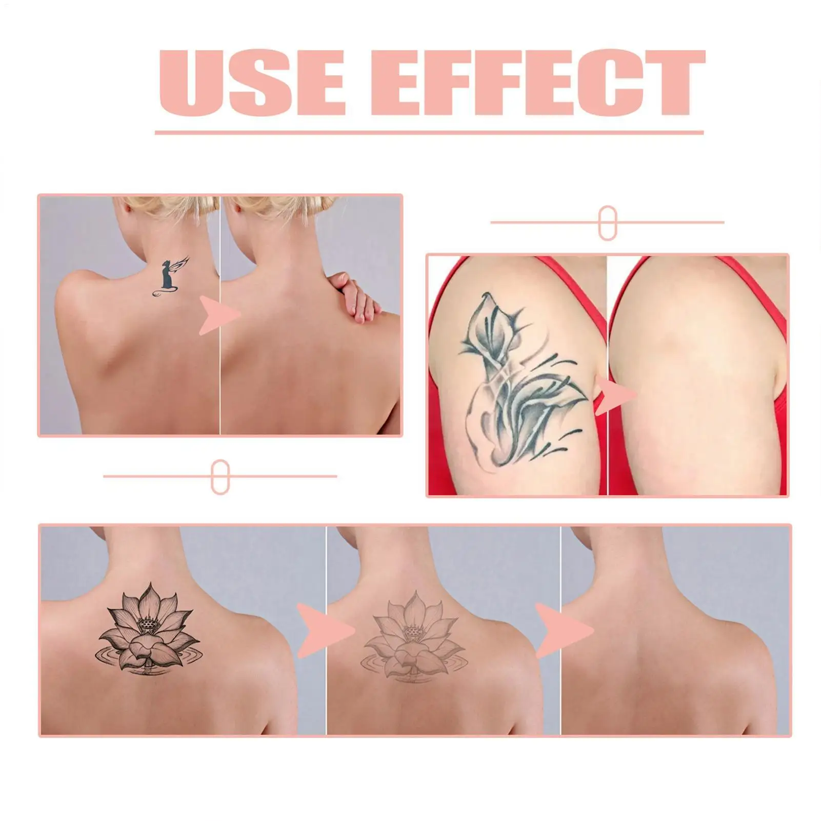 كريم تنظيف الوشم كريم تنظيف الوشم بدون ندبات أقصى قوة لون يتلاشى التنظيف السريع وإزالة الوشم #5