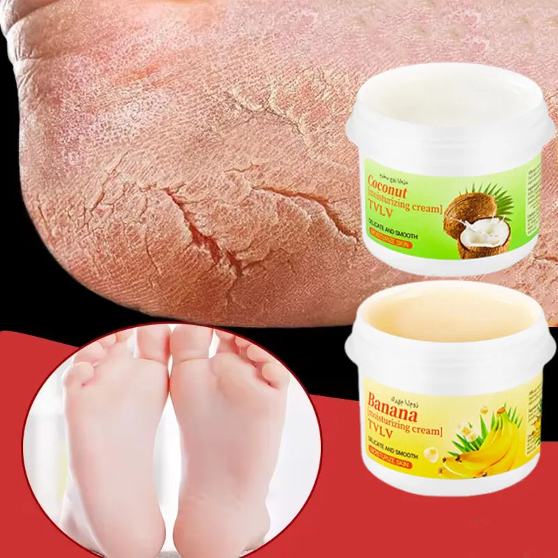 Crema para pies antigrietas a base de hierbas, productos reparadores de grietas en el talón, exfoliación, eliminación de piel muerta, suavizante, hidrata, cuidado de la piel suave