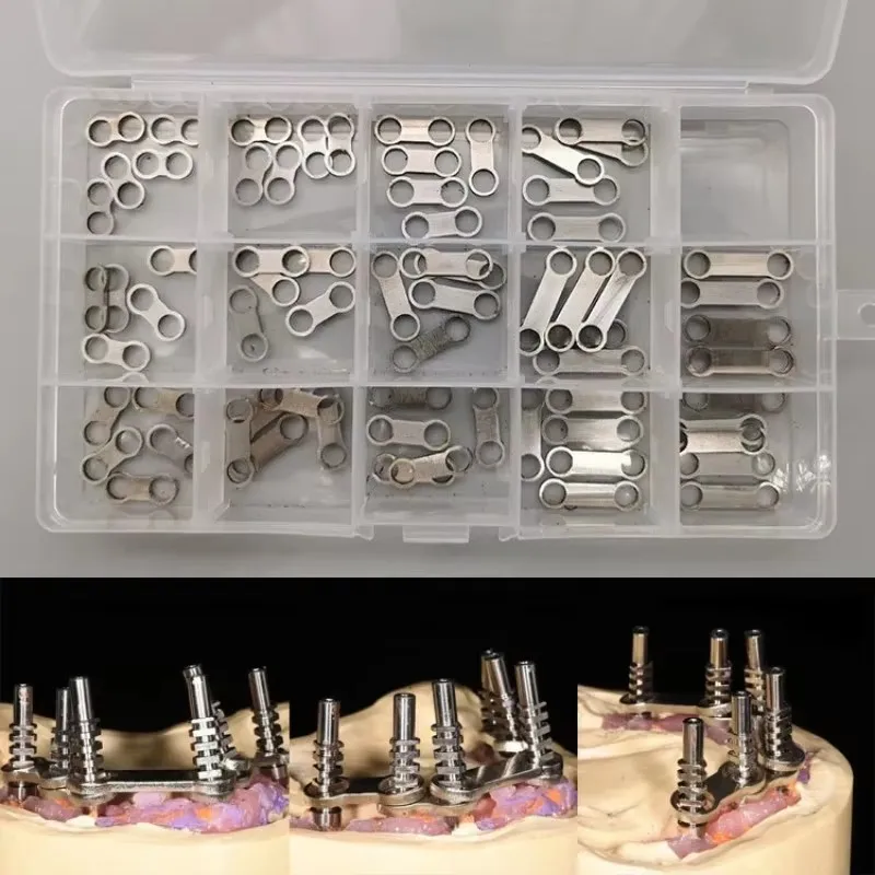 70Pcs Connecting Rods Dental Tools All on 4 Form Dental Prosthesis Metal Implant Supported Overdenture Bar 304 Stainless Steel