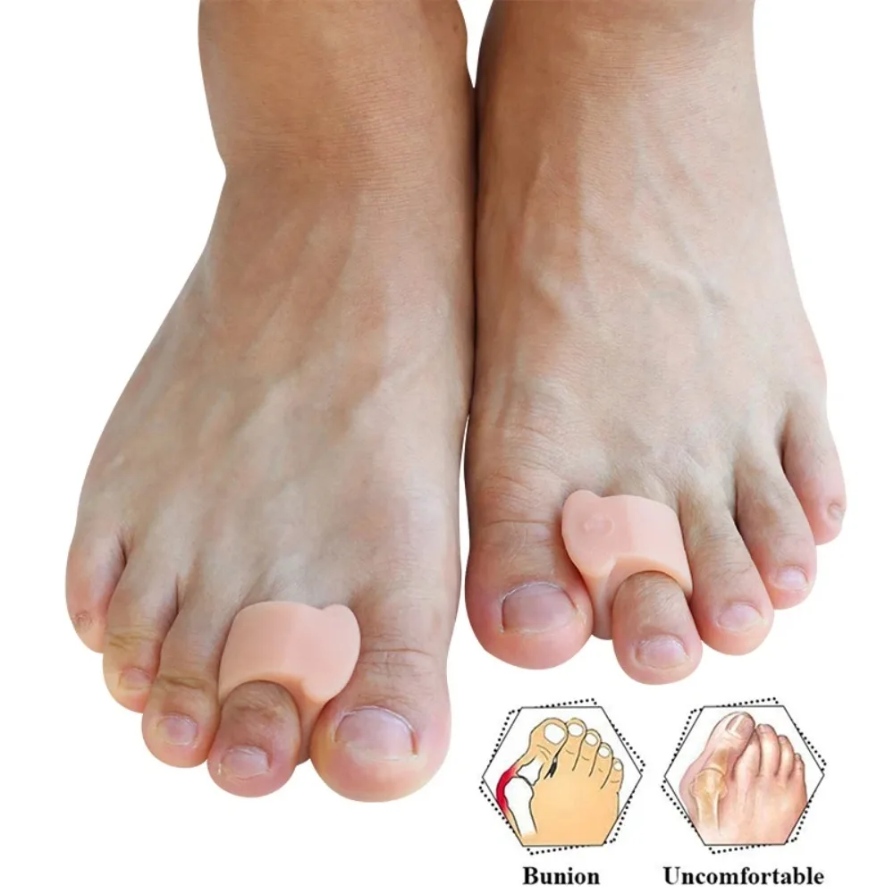 RHBJ 2/4 Stück weiche Gel-Zehenspreizer, Zehenabstandshalter, Bunion-Korrektor für überlappende Hallux-Valgus- und Hammerzehen-Fußpflegewerkzeuge – Detail 3