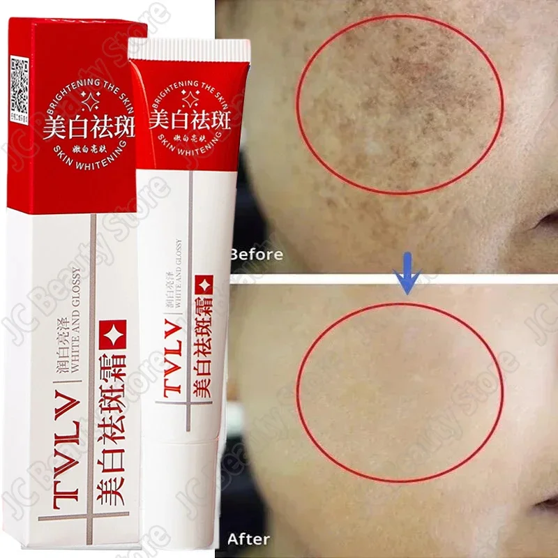 Whitening Freckle Cream Melasma Dark Spots Pigmentation Removal Products Fade Stain Melanin Repair Brighten Korean Skin Care