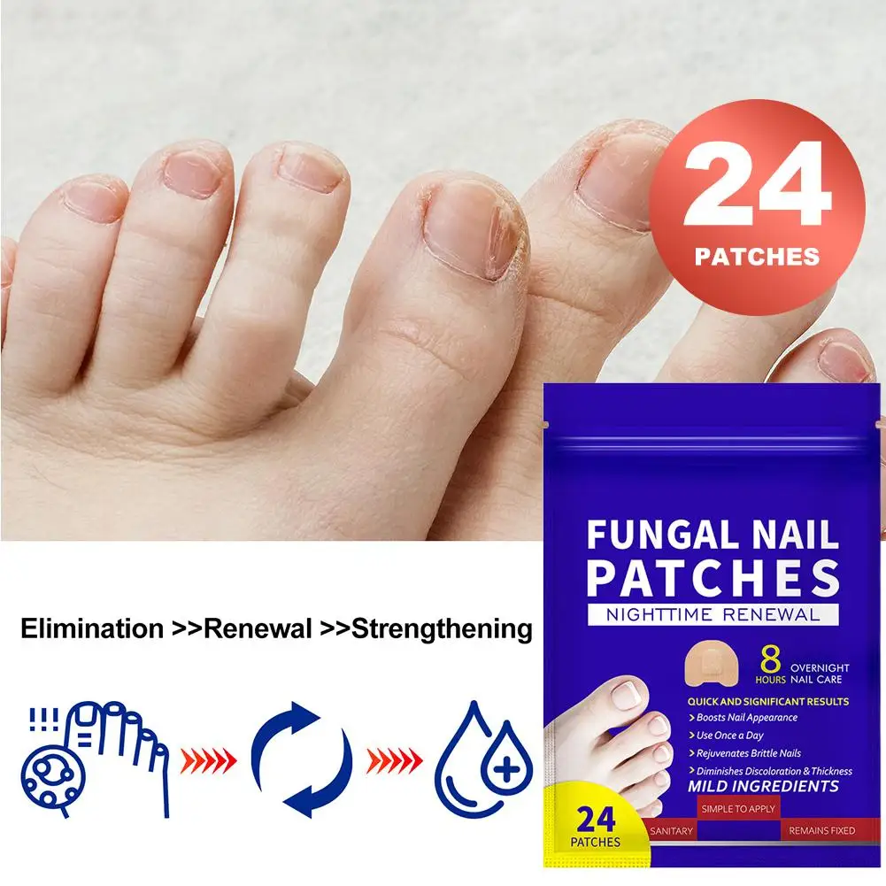 Nail Repair Patches Toenail Renewal Correction Sticker Paronychia Recovery Pedicure Tools Split Nails Protection Tape