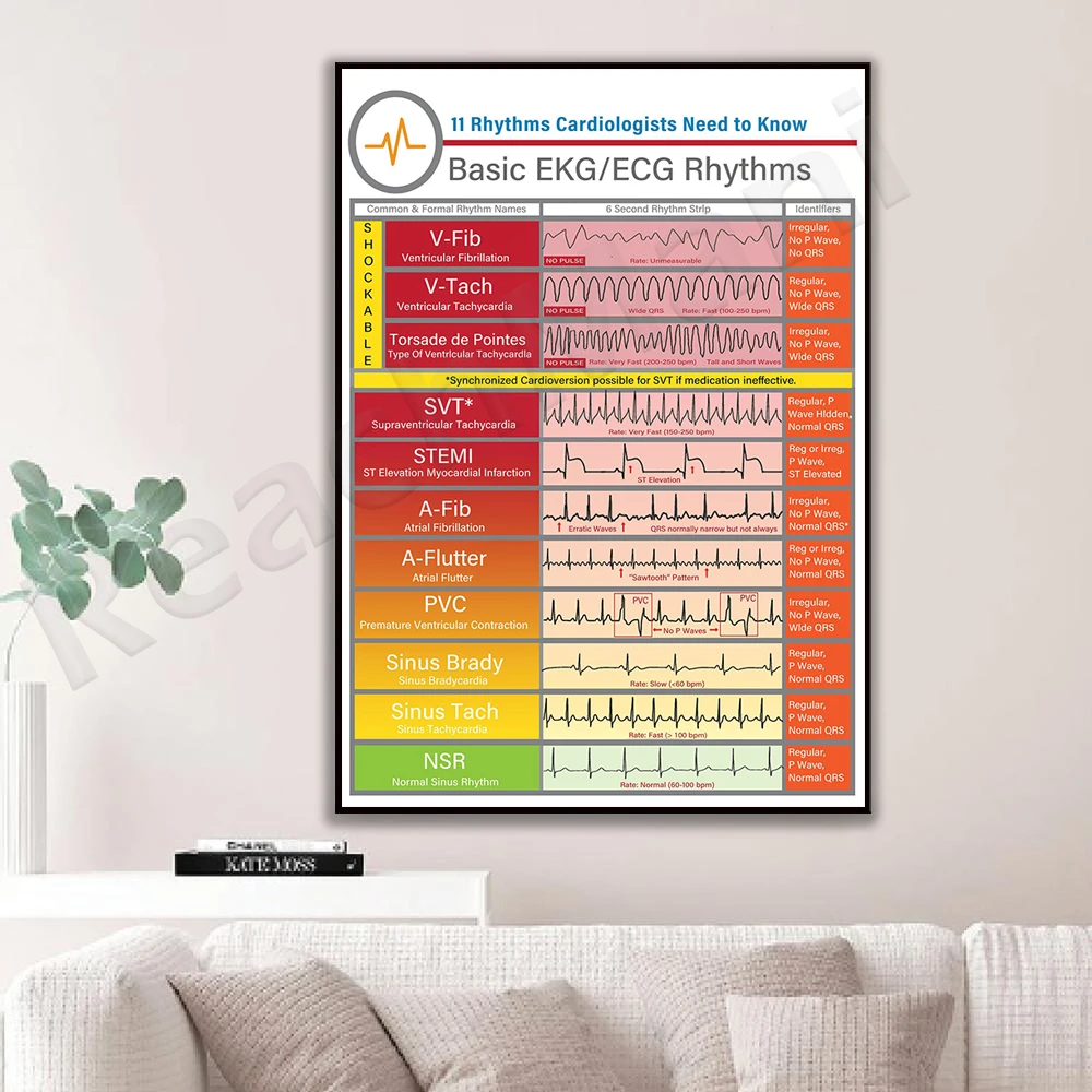 Basic EKG-ECG Rhythm Poster, Nursing School Poster, EKG Study Guide Poster, Nursing Notes Poster, Nurse Week Gift