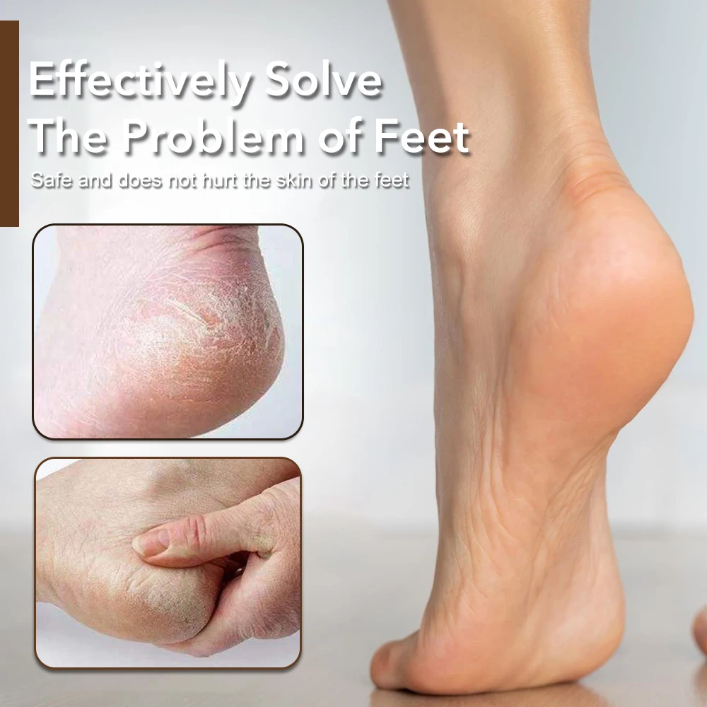 1 قطعة أداة باديكير عرموش ملف القدم المهنية العناية بالقدم يزيل الجلد الصلب الكالس مزيل قدم الغسيل الاستخدام الرطب والجاف