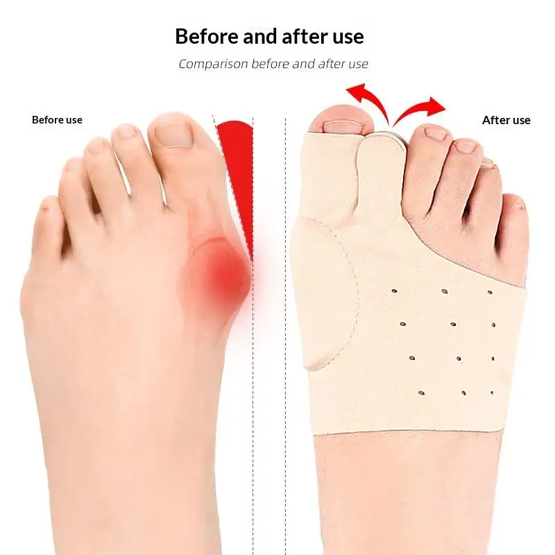 【B】1Pair Toe Separator Corrector Hallux Valgus Bunion Toe Straightener Foot Pain Relief Bone Thumb Adjuster Pedicure Tools