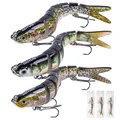 25g Set