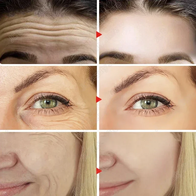 Original Wrinkle Face Set Firming Lifting Anti-aging Serum Fade Fine Lines Eye Stick Improve Puffiness Korean Skin Care Products