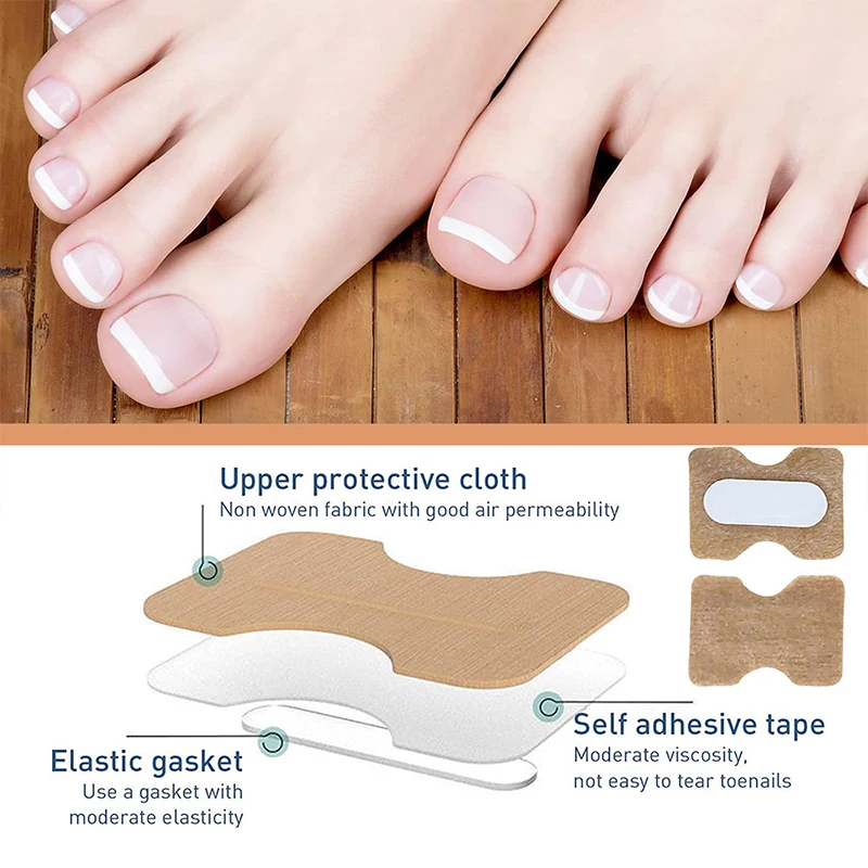 ملصقات تصحيح الأظافر الناشئة ، رقع مصحح أظافر القدم ، علاج البارونيشيا ، أداة العناية بالأظافر ، 60: 50