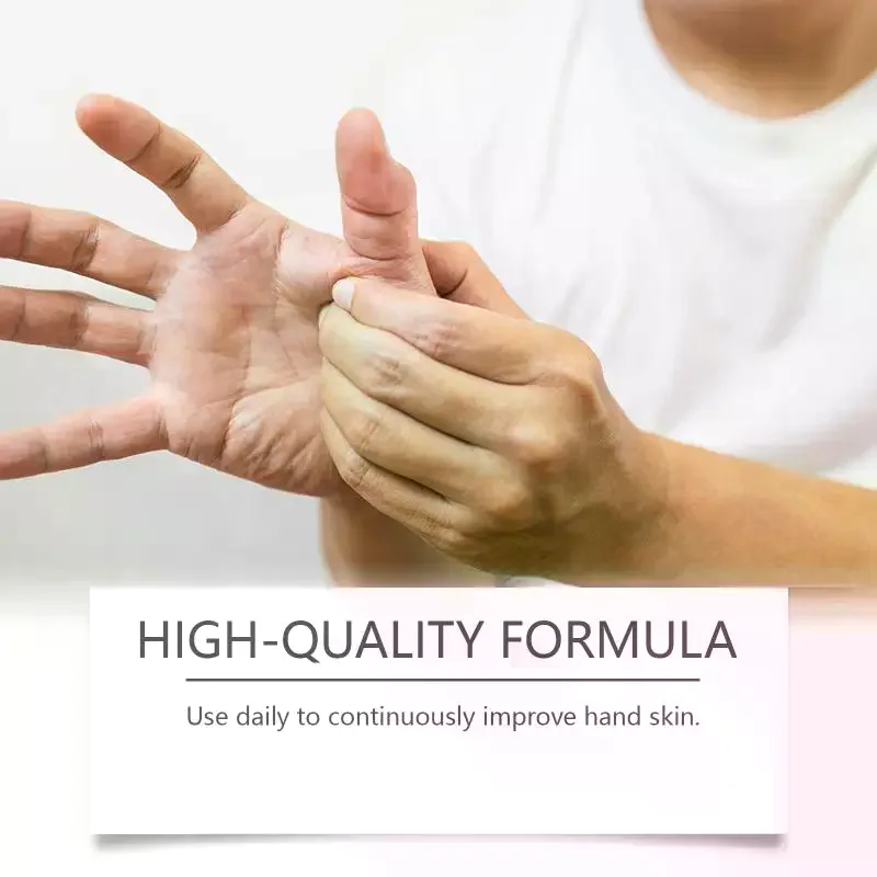 /YOV/Finger Hand Numbness Therapys Tendon Sheath Ointment Swollen Wrist Medicine Muscle Joint Relief Balm Relief