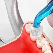 

Dental Orthodontic Aesthetic Printing Kit for Posterior Teeth - Quick Build Restoration Dentistry Tools Set