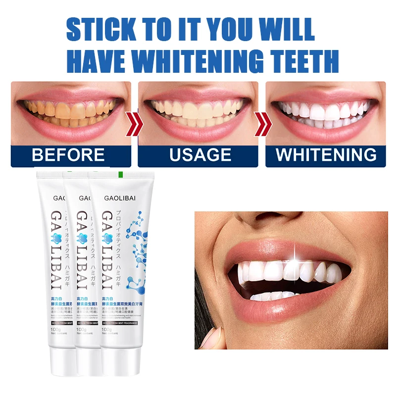 whitening teeth toothpaste dental calculus remover mouth odour removal bad breath Preventing Periodontitis fluoride toothpaste.