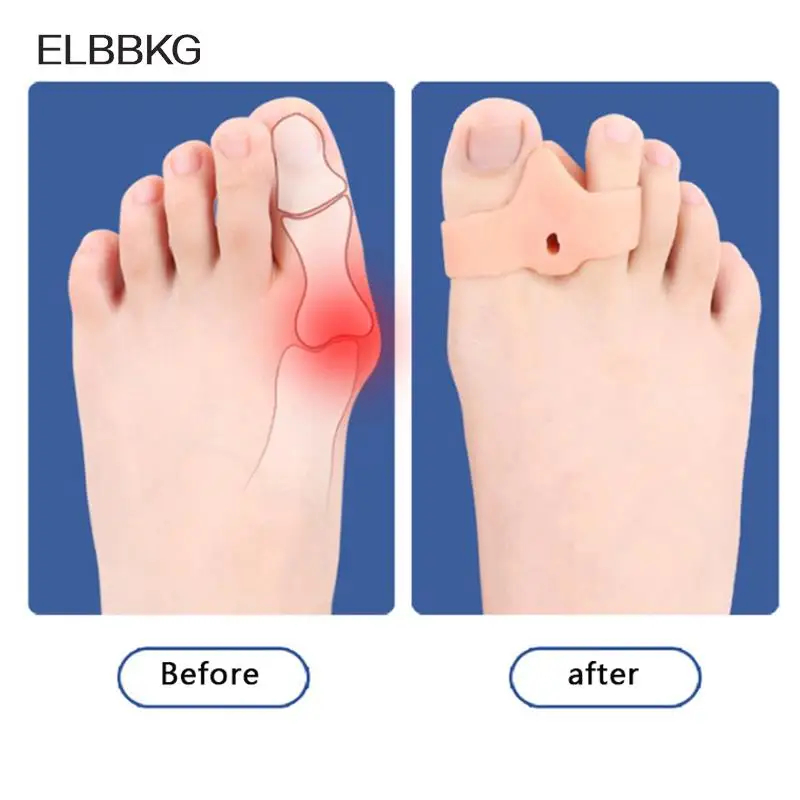 2PCS Silicone Gel Thumb Corrector Bunion Foot Toe Hallux Valgus Protector Separator Finger Straightener Adjuster Foot Care Tool