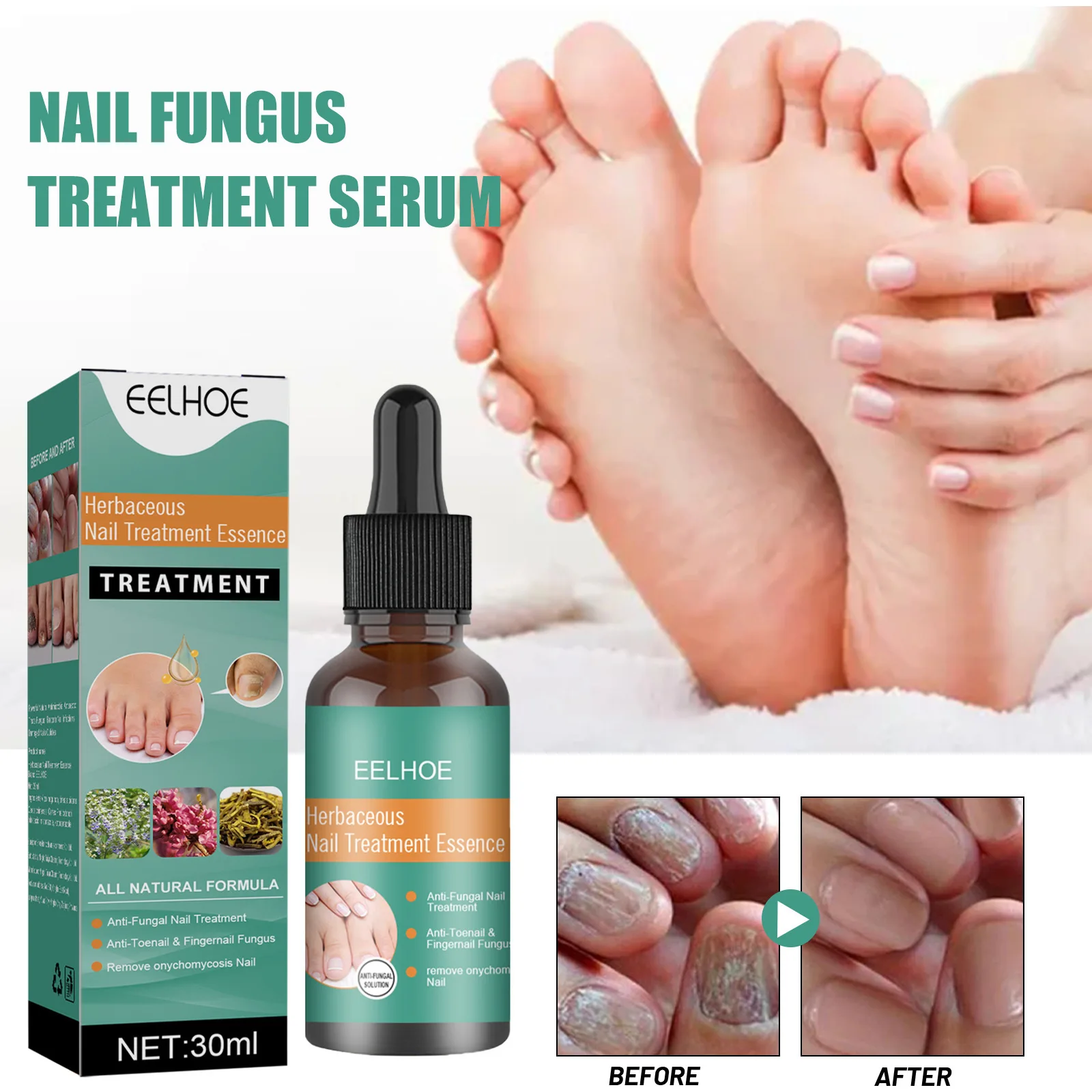 

Uñas Ringworm of Nails Treatment Nail Care Solution Foot Nail Thickening in Shining Armour Nails Concavo-Convex Grey Nail Repair