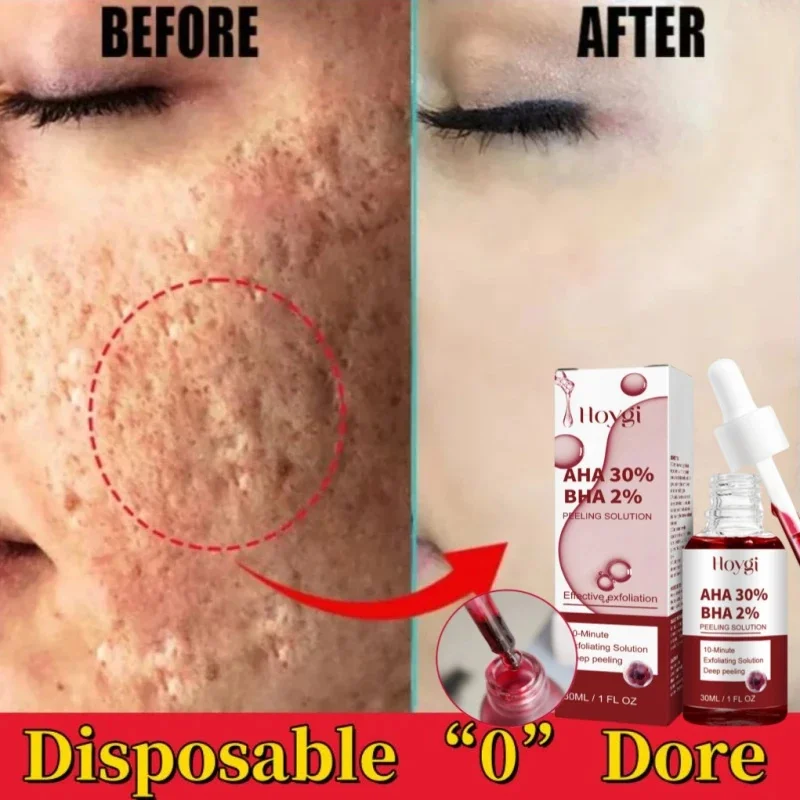 Pore Shrinking Serum Peeling Face ถอดรูขุมขนขนาดใหญ่กระชับ Repairing Facial Pore Minimizing ขัดผิวที่มีประสิทธิภาพ