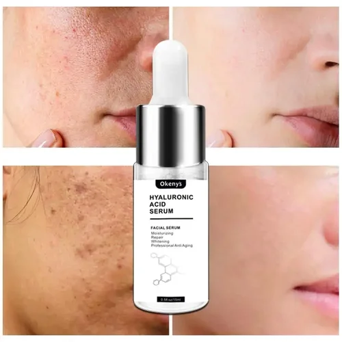 Imagen 2 del producto 15ml de ácido hialurónico para suero Facial hidratante blanqueamiento esencia Facial crema Facial reparación antienvejecimiento Lifting reafirmante cuidado de la piel