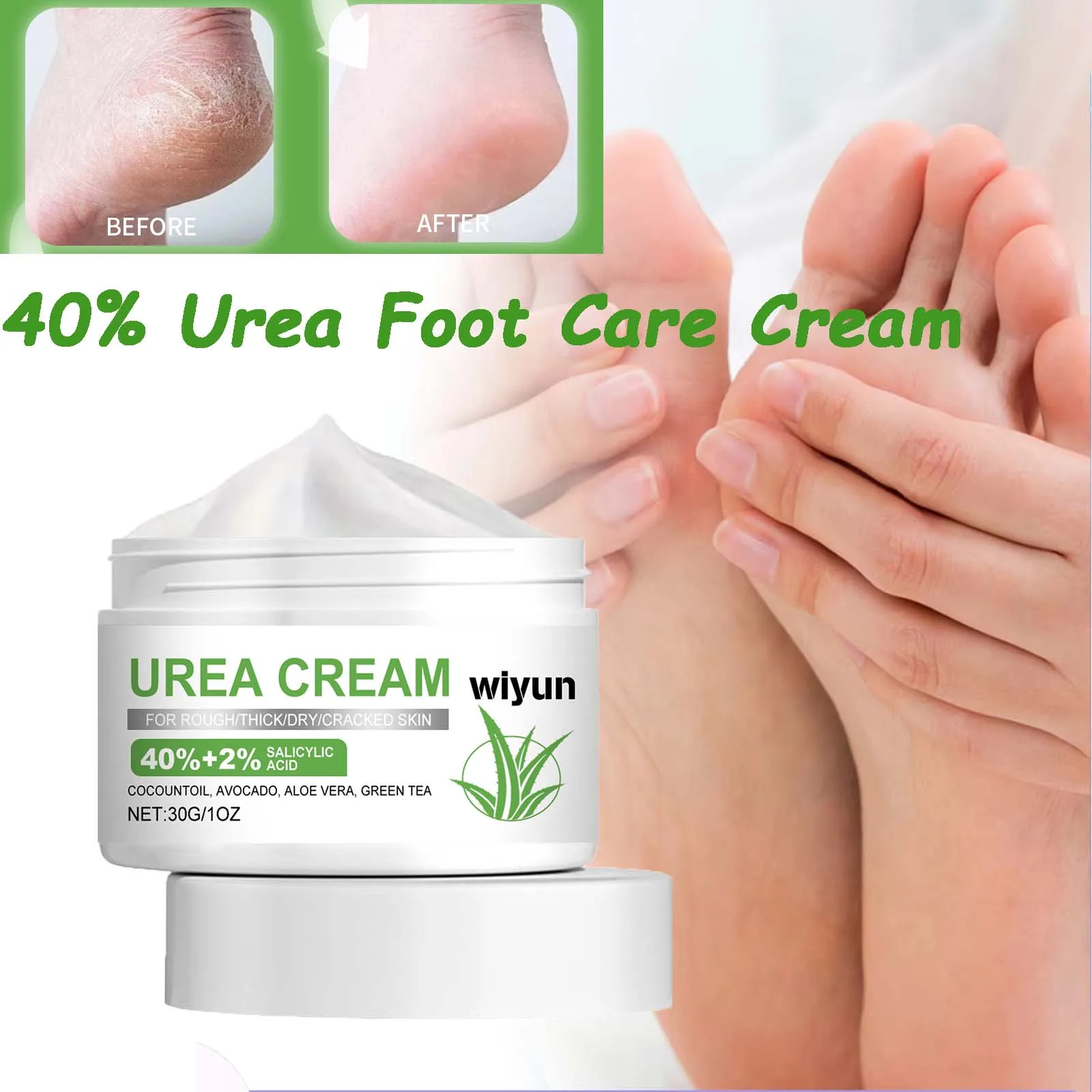 40% كريم يوريا للعناية بالقدم بين عشية وضحاها ترطيب يزيل الجلد الميت مغذي جاف خشن إصلاح الكعوب المتشققة والرطوبة