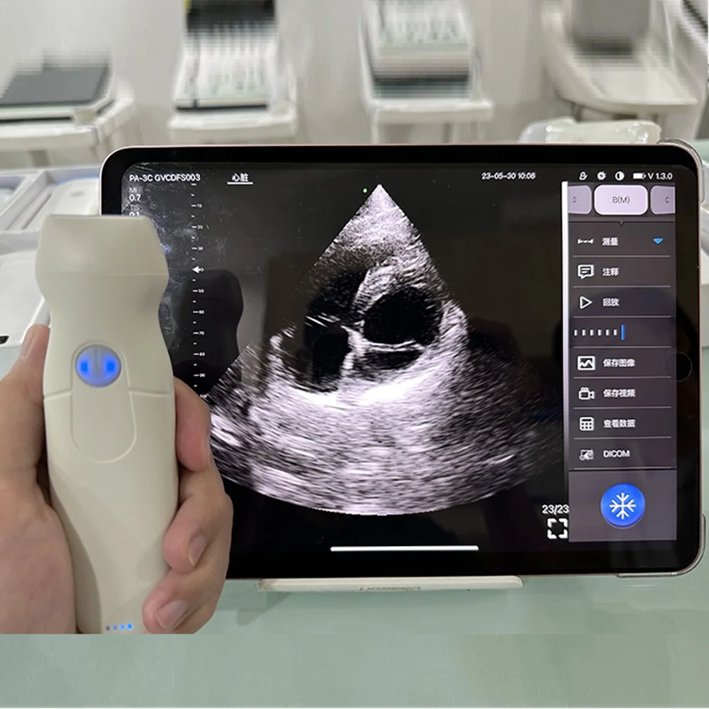 64E Handheld Wireless Color Ultrasound Doppler Phased Array Cardiac Probe with Continuous Wave Support IOS Android Windows