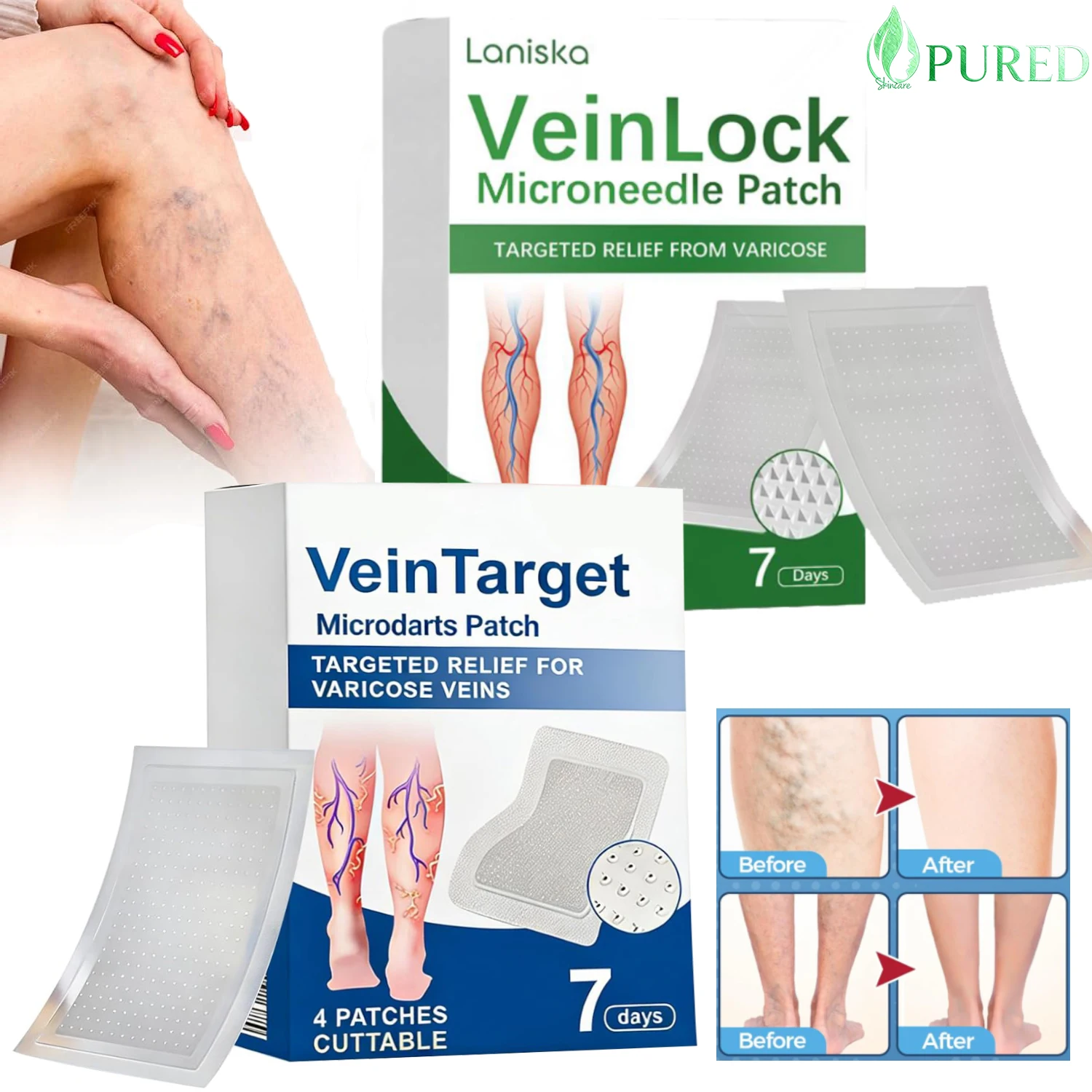 Legs Patchs Vein Target Natural Ease Blood Circulation Patch Professional Varicose Veins Treatment Ingredients Leg Treatment