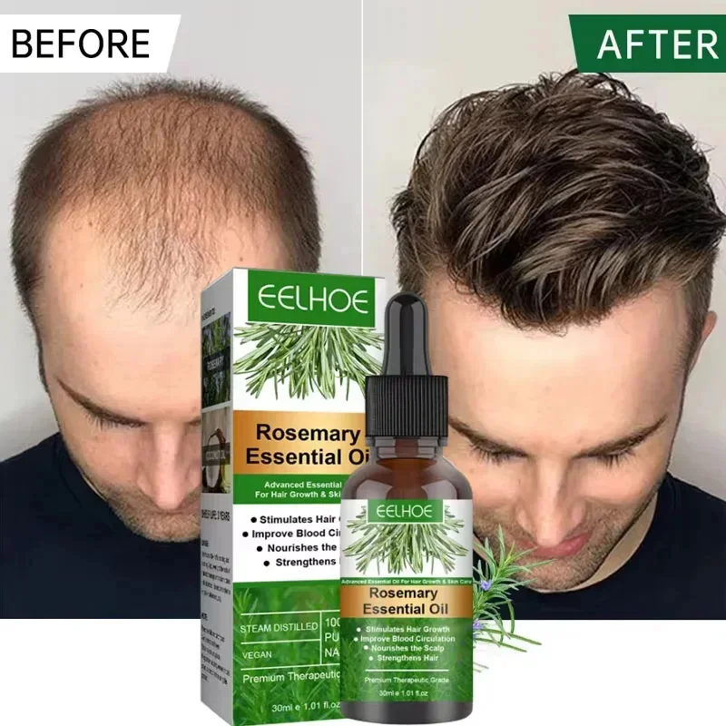 

Rosemary Hair Growth Essentiall Oil Anti Hair Loss Products Repair Damage Dry Frizzy Serum Nourish Hair Scalp Follicles Care