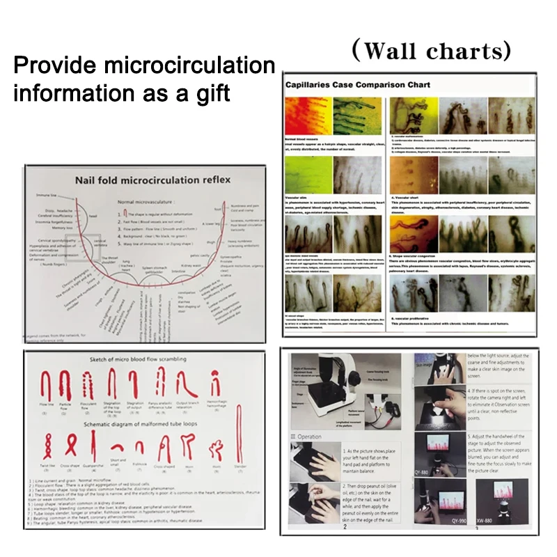 Microcircolazione capillare professionale XW880 Microscopio capillare Osservatore di sangue Macchina integrata Display LCD a colori