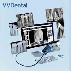 VV Dental Sensor X-Ray Digital Sensor Intraoral Digital System HD Image Dentistry Equipment Dentist Tools 13 Language