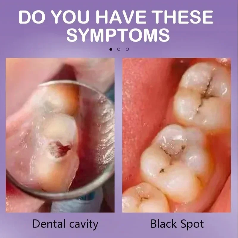 Зубная кариес, восстанавливающая зубная паста для предотвращения кариес, зубная паста, лаксация, пародонтис, удаление желтого отбеливающего продукта для зубов