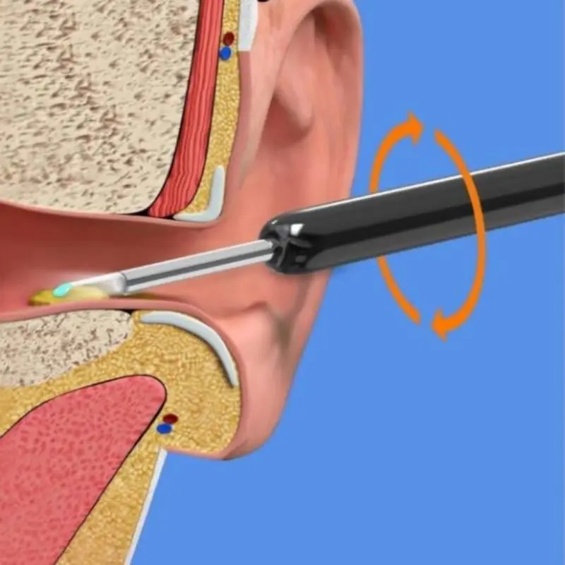 Wi -Fi 보이는 왁스 제거 스푼 USB 1080P hd로드 otoscope 귀 클리너 귀지 제거 도구, 안드로이드 iOS 전화에 적합