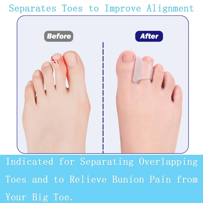 Pexmen 2Pcs/Pair Toe Separator for Overlapping Toes Big Toe Alignment Bunions Corrector Correct Toes and Bunion Relief Protector