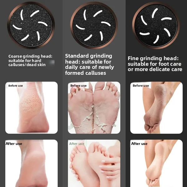 Electric Foot File with Battery Display Rechargeable Type-C Waterproof Anti Splinter Dead Skin Remover Pedicure Tool for Women