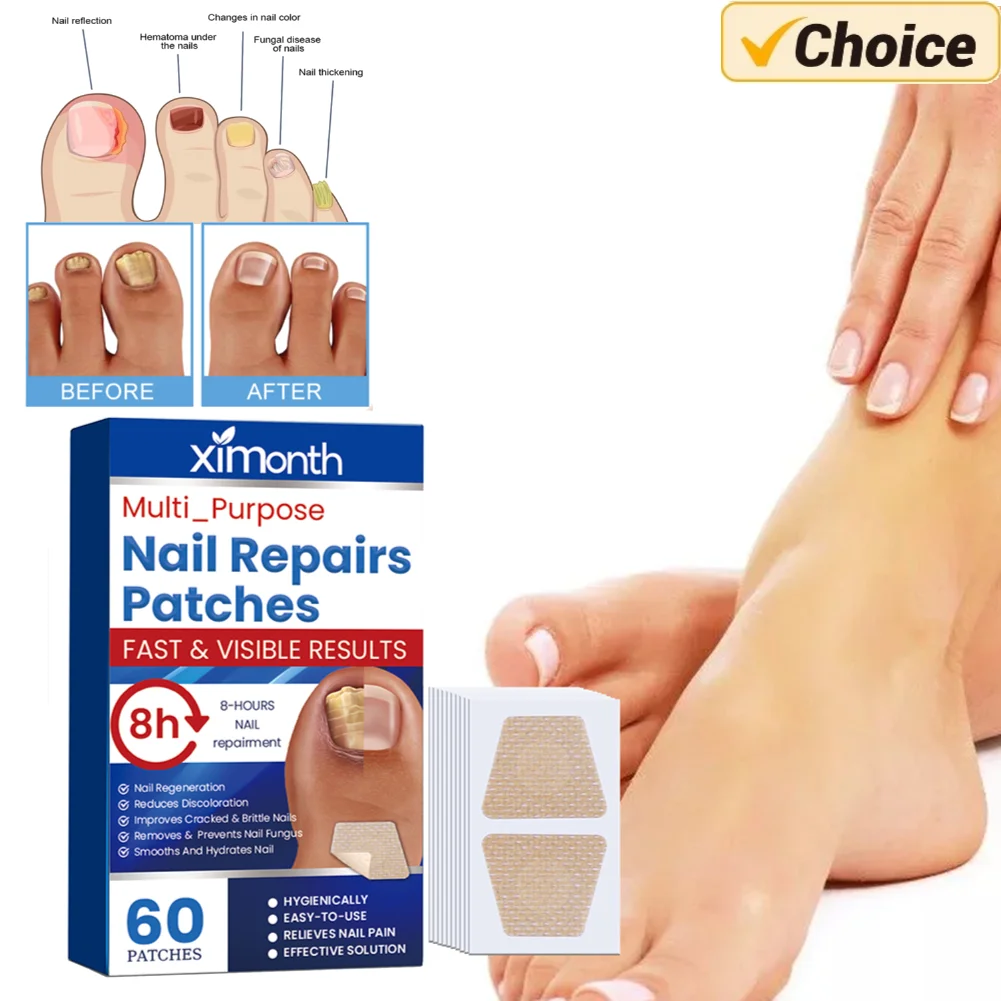 60Pcs/Box Toenail Fungus Patch Breathable Nail Repair Patches Nail Ingrown Correction Stickers Waterproof Sticky Foot Care Tools