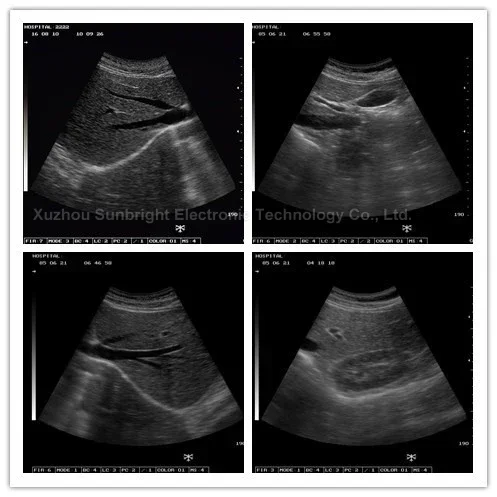 Professional medical device cardiac ultrasound portable ultrasound scanner for human being