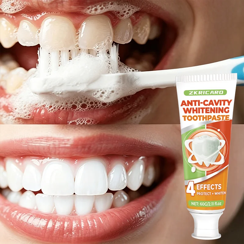 Remineralizing Toothpaste - Pasta Dental Anti-Caries, Limpieza Profunda, Refresca