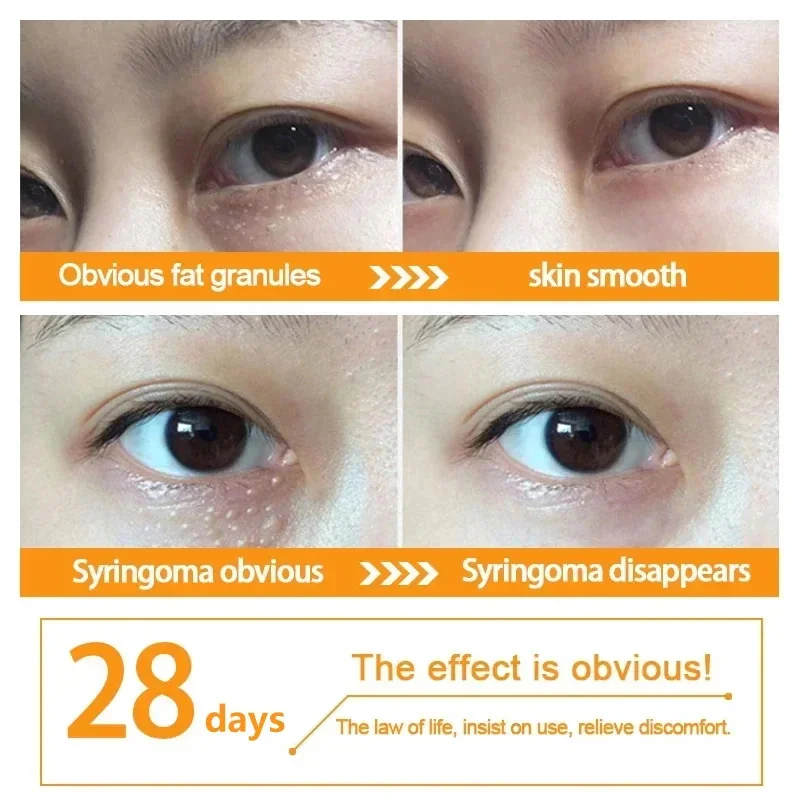 Crema para Ojos eliminadora de gránulos de grasa, antihinchazón, antiinflamatoria, crema firme, Reduce las ojeras, desvanece las líneas finas, barrera de reparación Sk