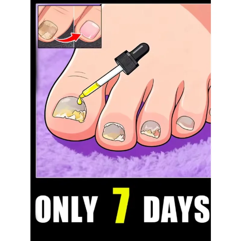 

77ht Rejuvenator - Технология предотвращения грибка - Регулируемый контроль температуры и датчик безопасности