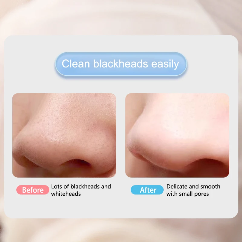 Double Headed Facial Blackhead Removal เครื่องมือจมูกลึกทําความสะอาดสิวมือถือ Beauty Care เครื่องมือ Skin Care เครื่องมือเสริม