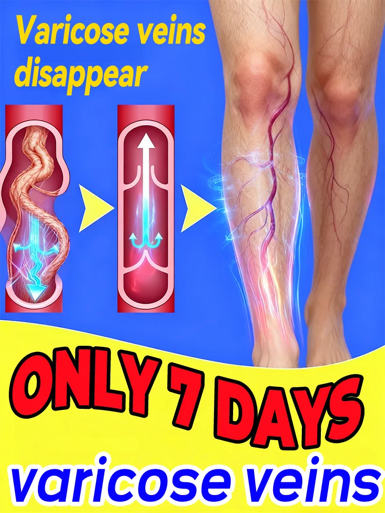 أدوات العناية بالساق تقلل من غير مريحة للساقين وتحسين الدورة الدموية والدوالي وقلم منتج العناية بالبشرة